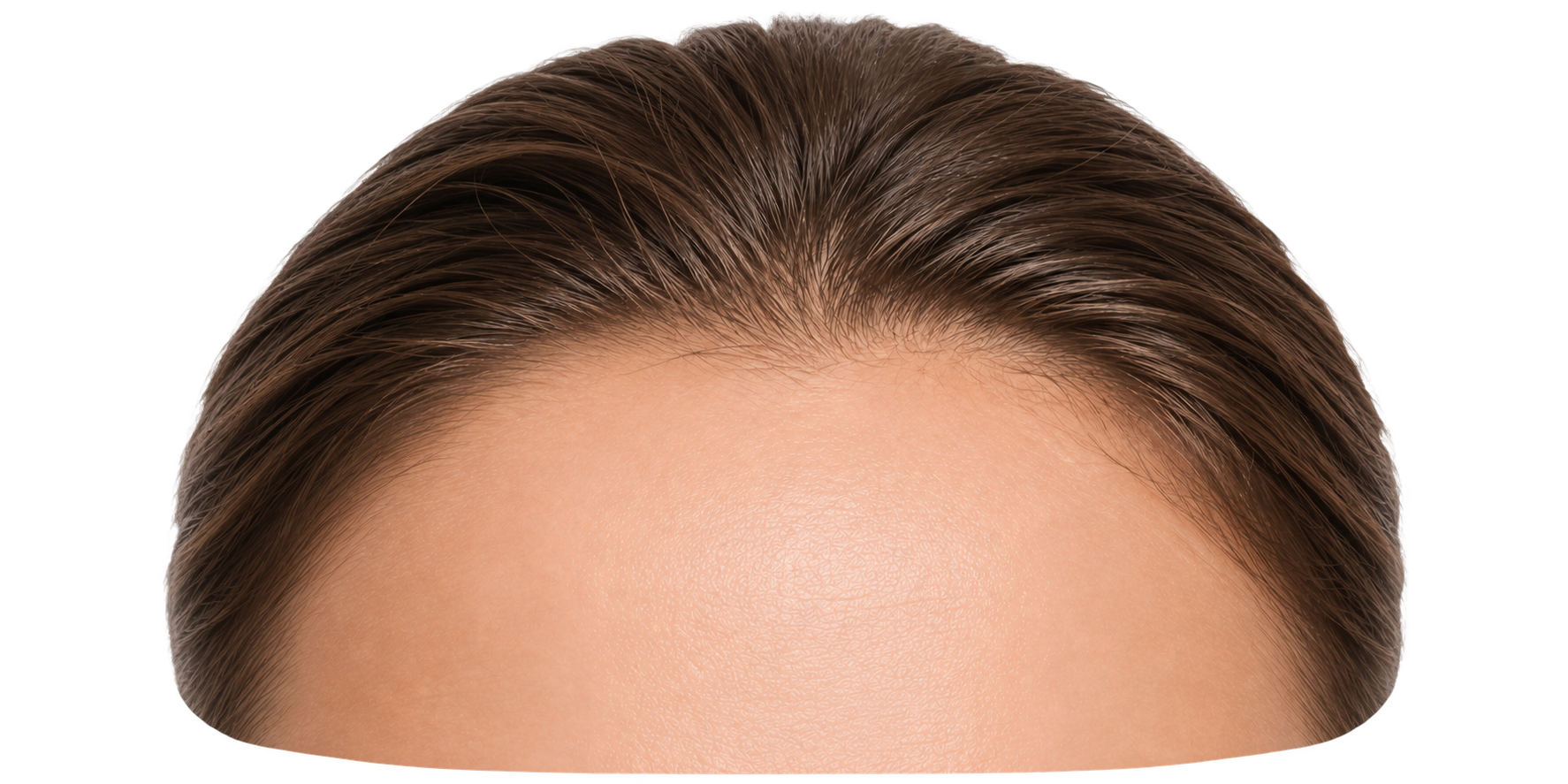 forehead