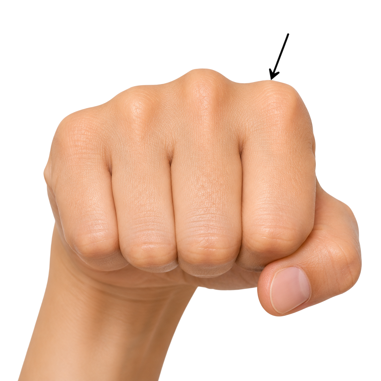 knuckle